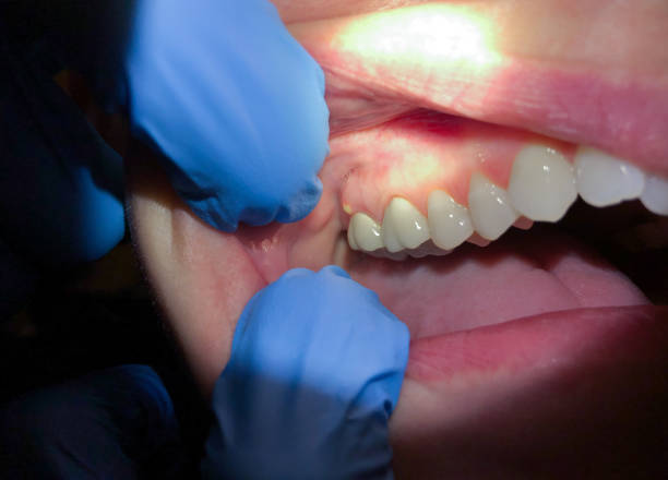 Best Walk-In Emergency Dental Services in Goddard, KS