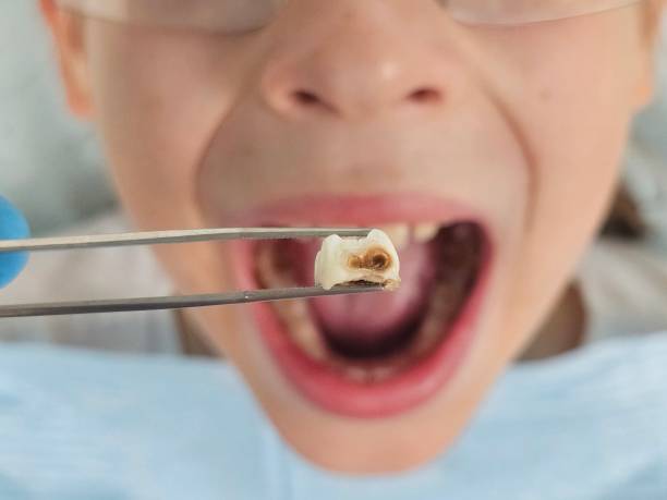 Best Urgent Dental Care for Toothaches in Goddard, KS