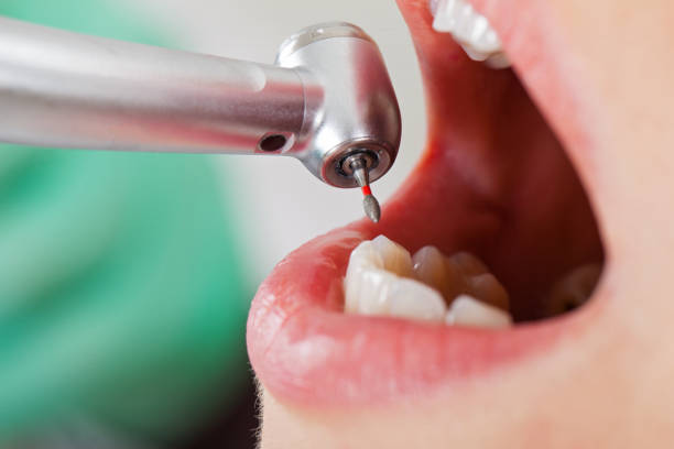 Best Broken or Chipped Tooth Repair in Goddard, KS